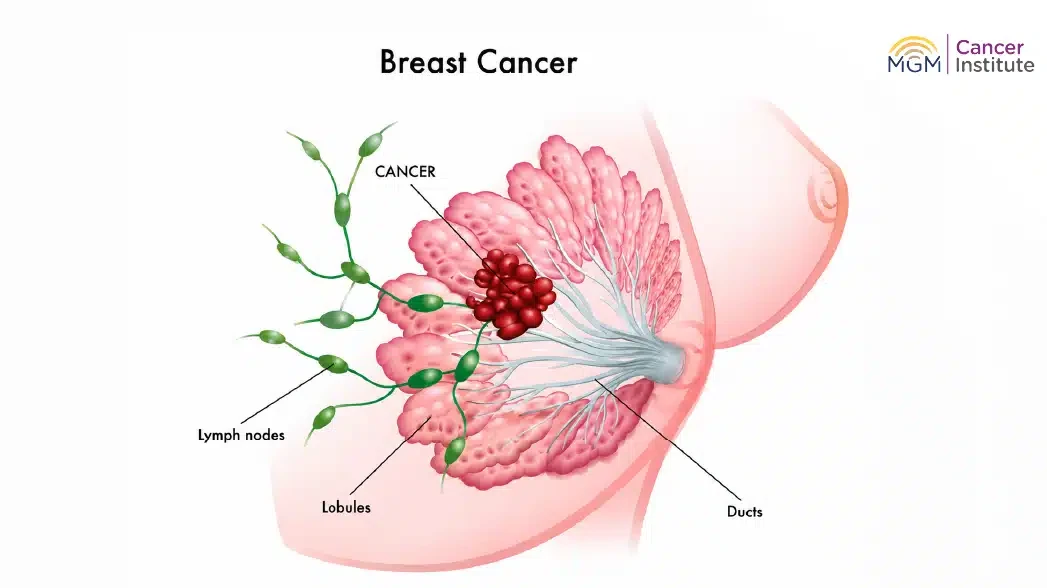 oncologist in chennai