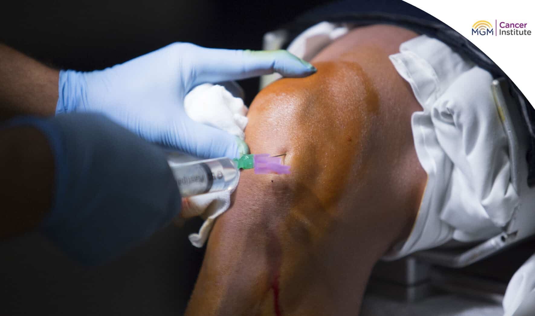 oncologist in chennai