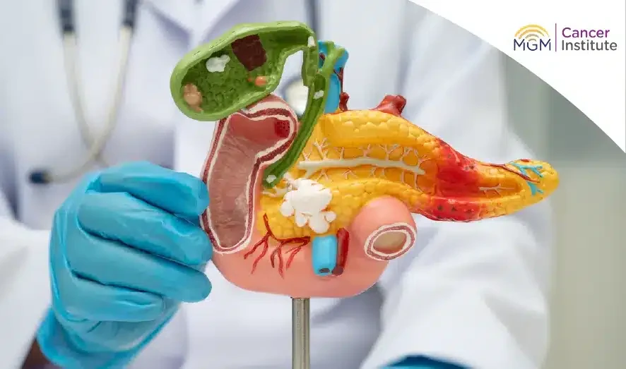 pancreatic cancer Awareness