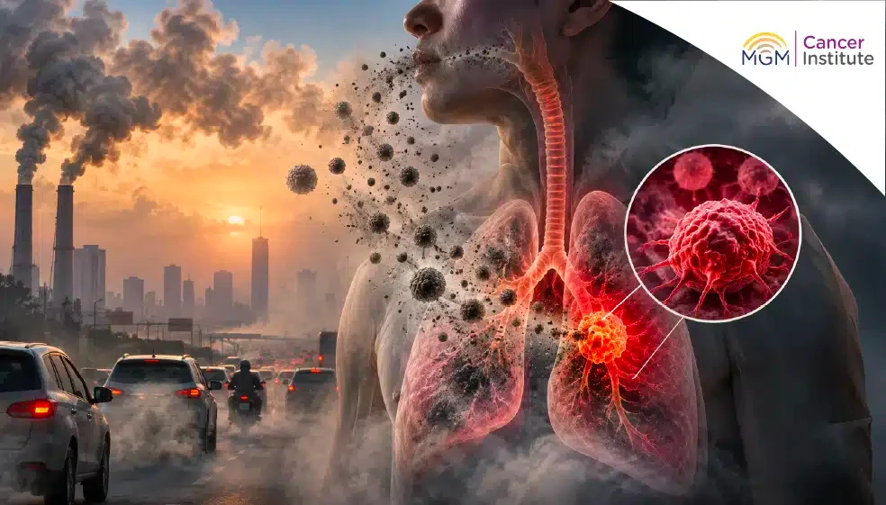 oncologist in chennai