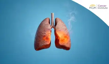 Lung Cancer Symptoms