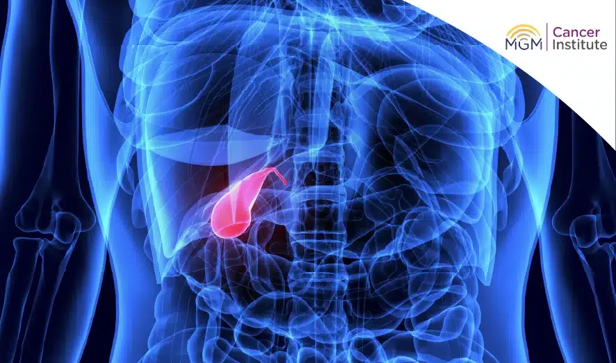 Gallbladder and Bile Duct Cancer risk